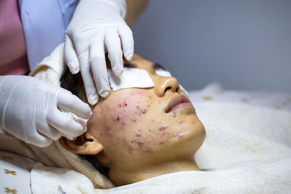 Injectable neurotoxin treatment at Clare Dermatology Nassau Bahamas